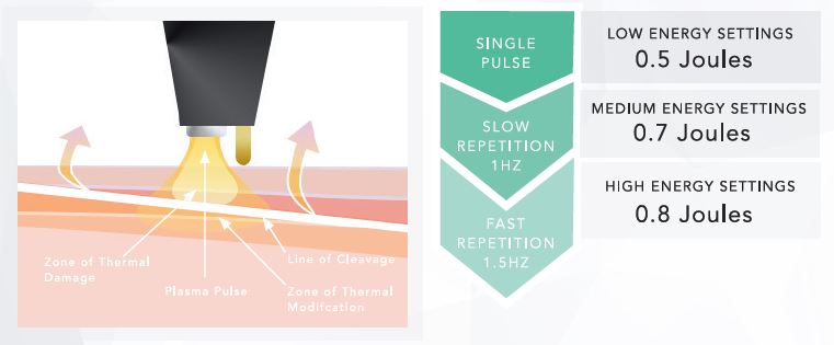 NeoGenSpa - Energy Settings